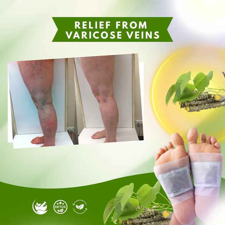 Herbal Giloy Detox Foot Patches for Body Detox Support and Stress Relief - Buy 1 Get 3 Free (20 Patches)